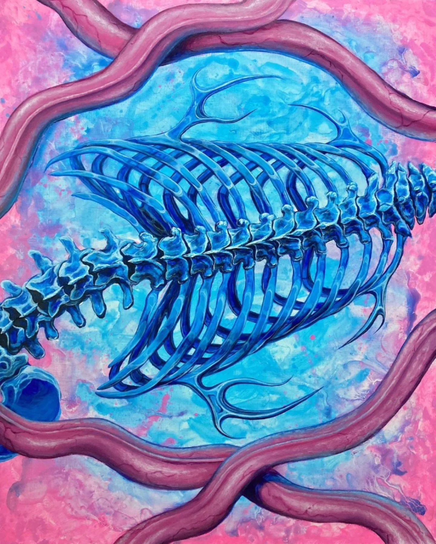 A colorful painting of a human skeleton with scoliosis on a pink and blue background.