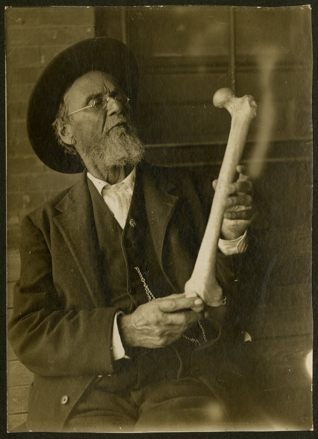 What is osteopathy?