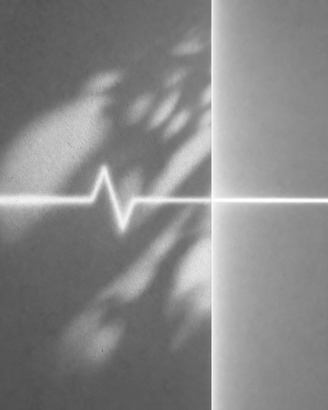 Burgess, R. L. (2026). Smartphone Photoplethysmography as a Digital Stress Biomarker: A Laboratory Validation Study