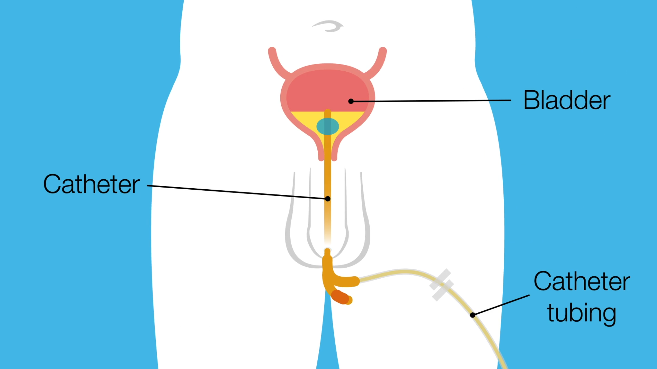 Prostate_08.png