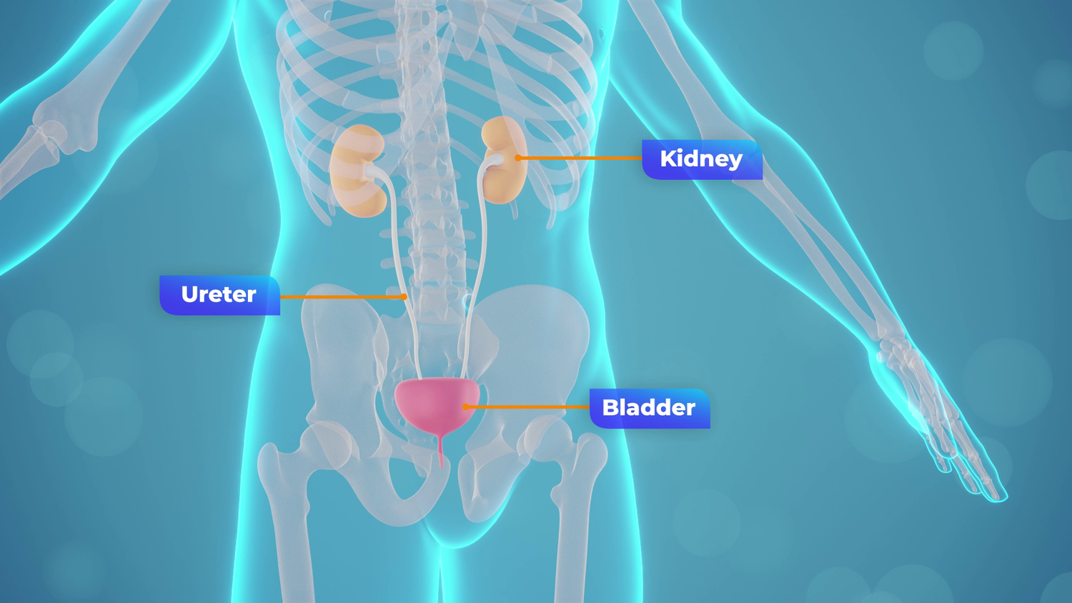 CKD_11.webp