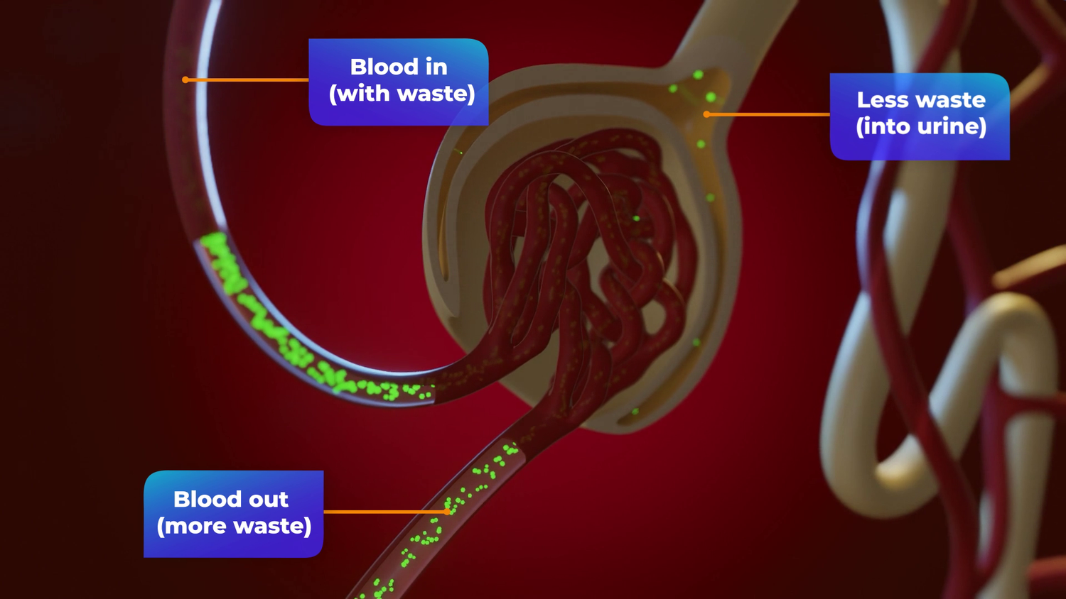 CKD_12.webp