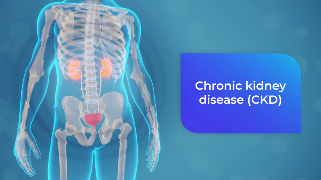 CKD_02.png