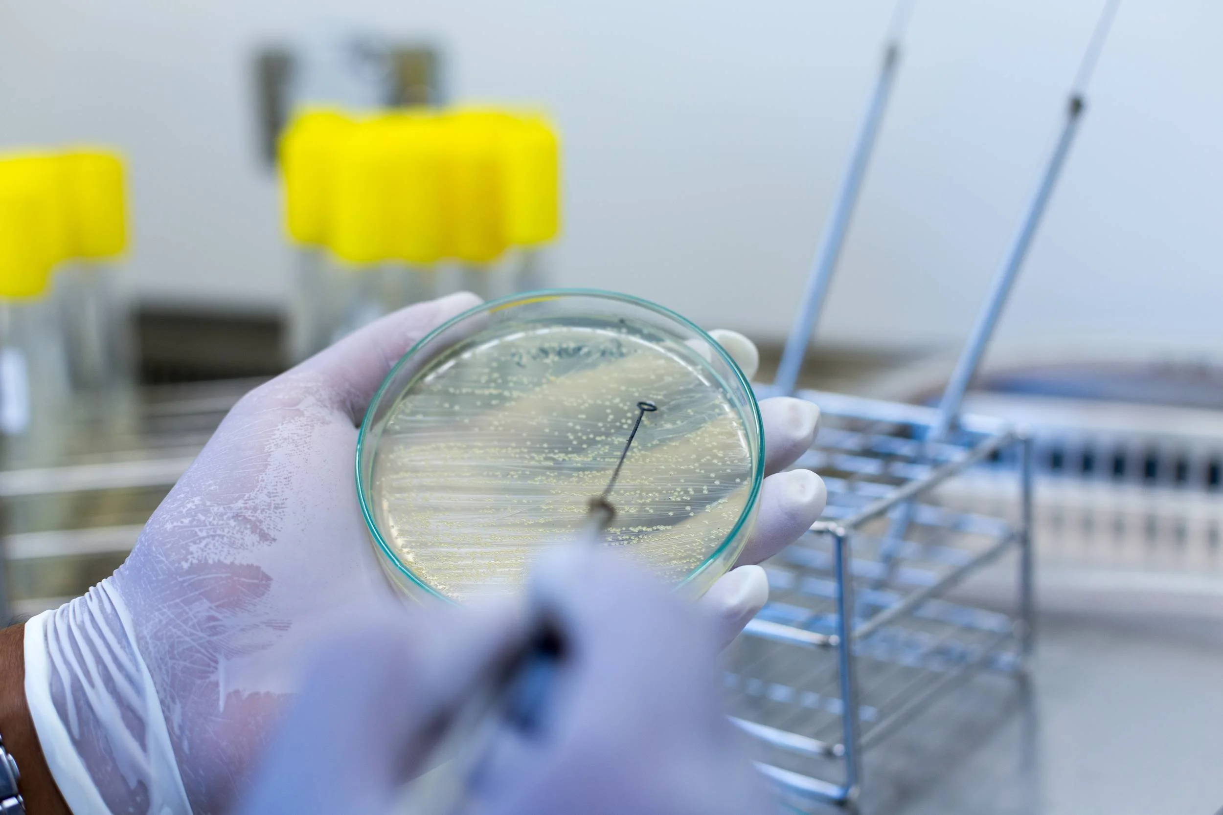 A gloved hand holding a petri dish with bacterial growth in a laboratory setting. There are yellow liquid containers and laboratory tools in the background.