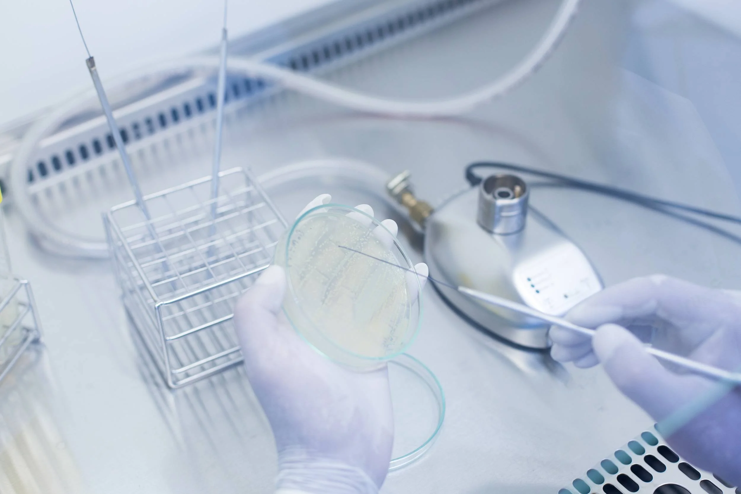 Laboratory technician wearing gloves handling a petri dish with bacterial growth, with lab equipment and a centrifuge in the background.