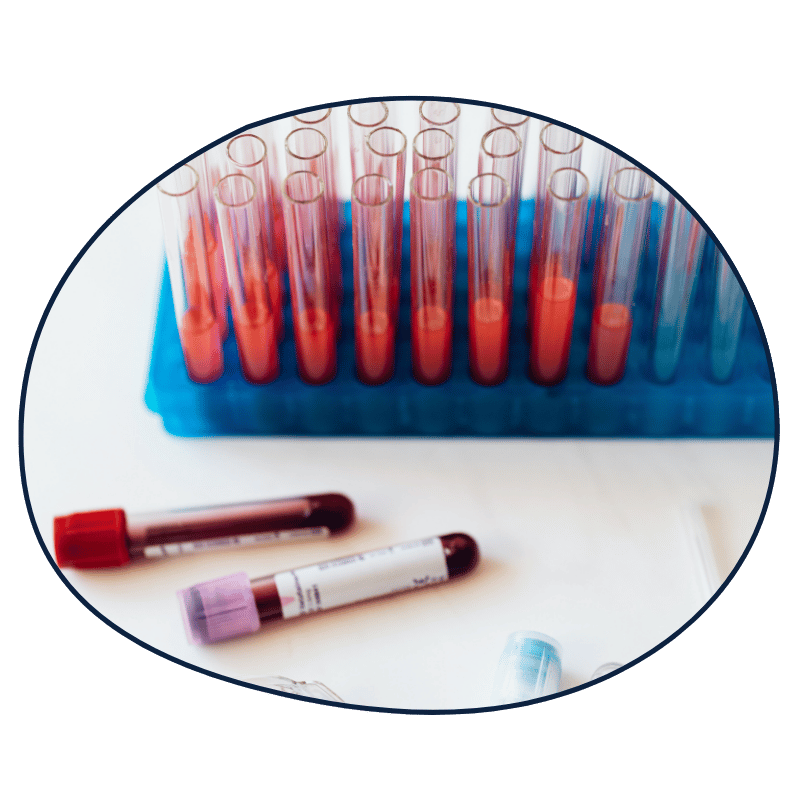 Set of test tubes in a rack with blood samples and blood collection tubes on a white surface