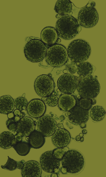 Microscopic view of clustered green cells or microorganisms in various sizes.
