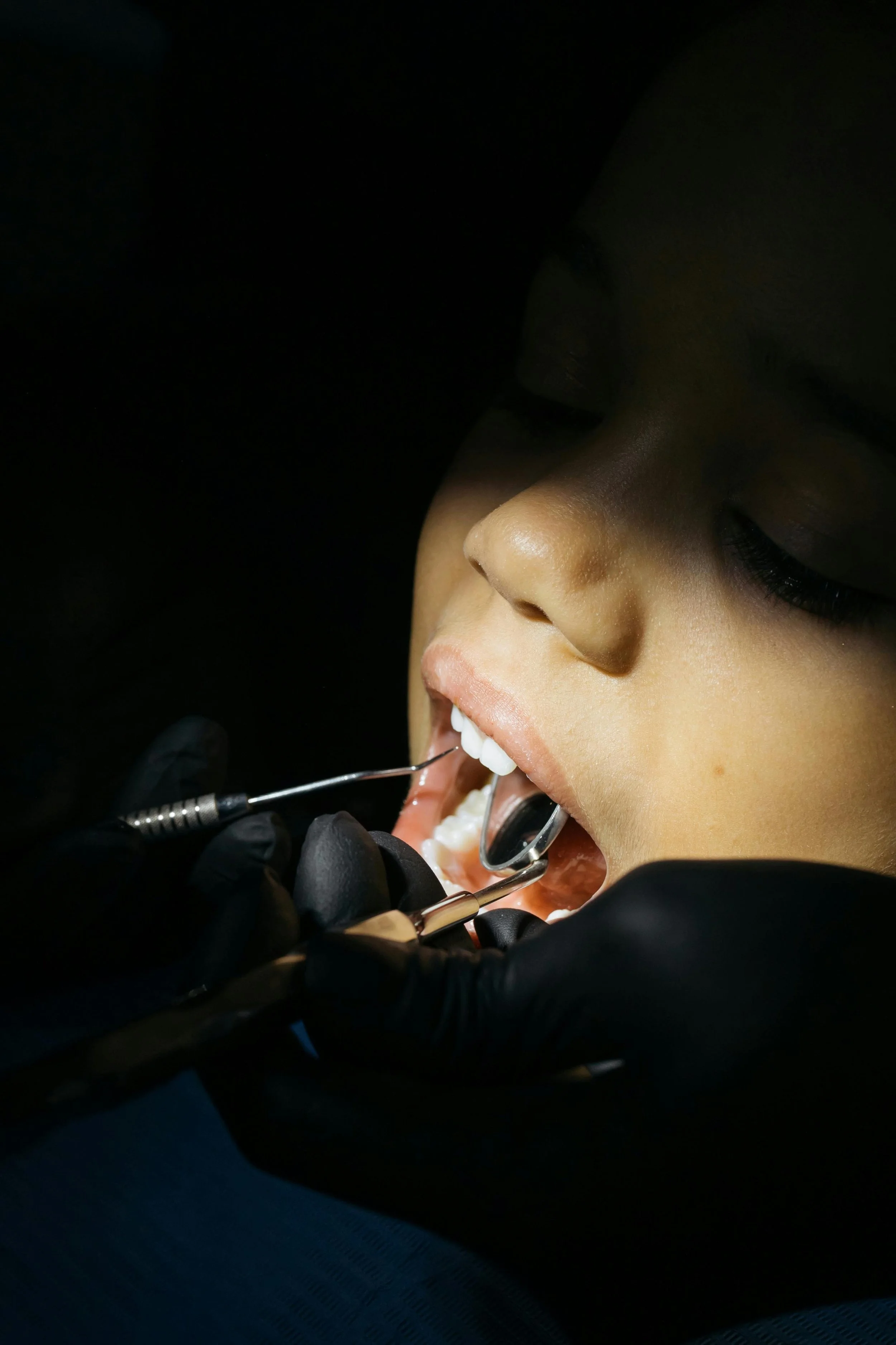 Dental Root Canals in Park City Utah