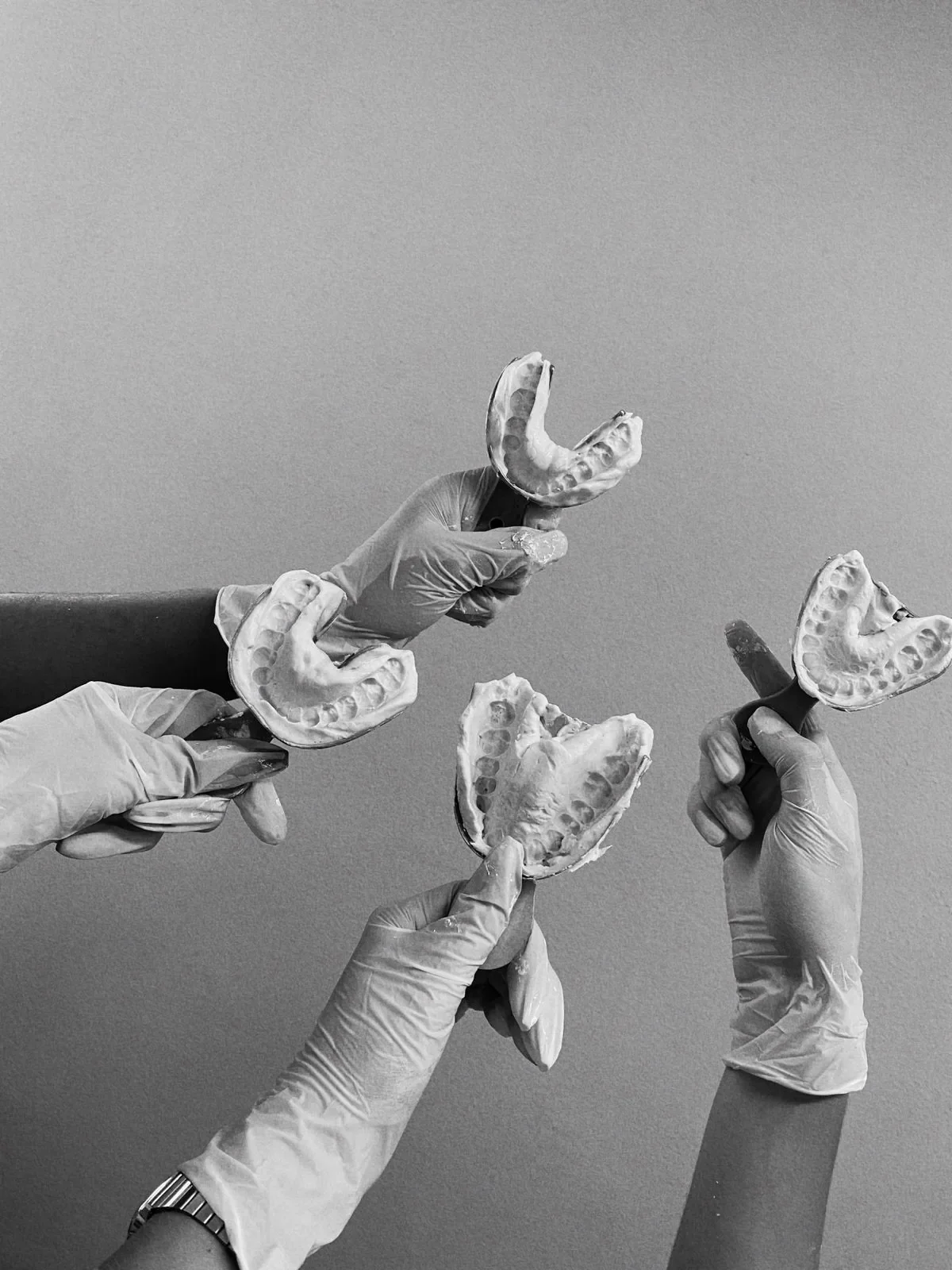 Four gloved hands holding dental rubber molds of upper and lower teeth against a plain background.
