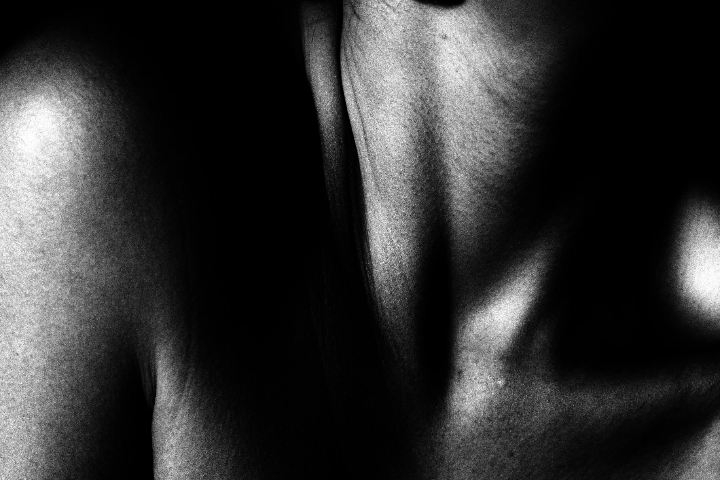 Close-up black and white photo of a person's face, focusing on the nose, lips, and surrounding skin.