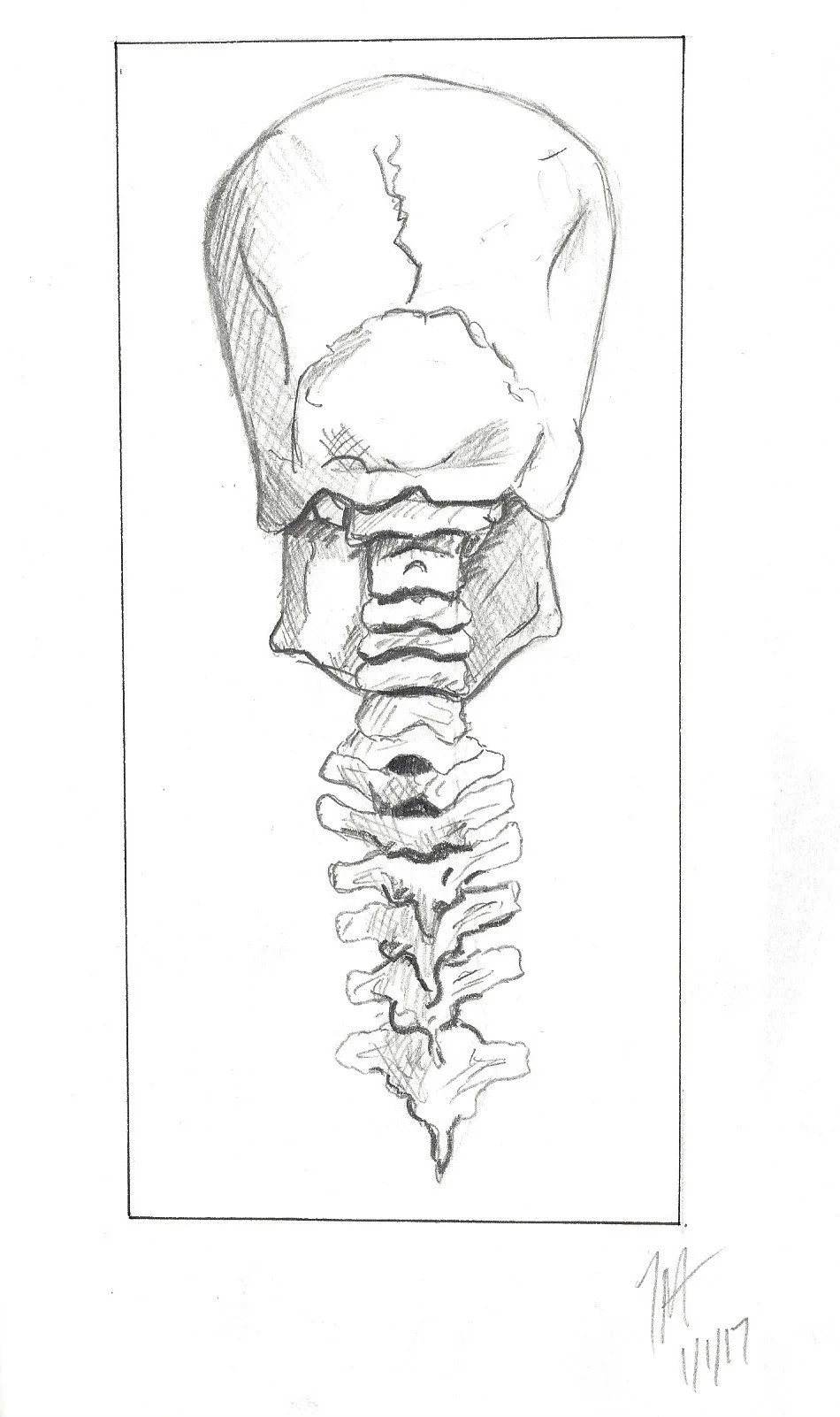 Skull and Spine.jpeg