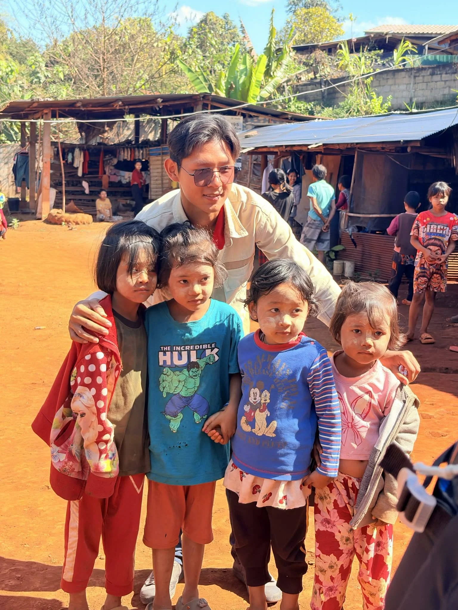 A man with sunglasses is surrounded by children with dust on their faces in an outdoor setting. Behind them are makeshift shops and houses made of wood and metal sheets, with greenery and a blue sky above.