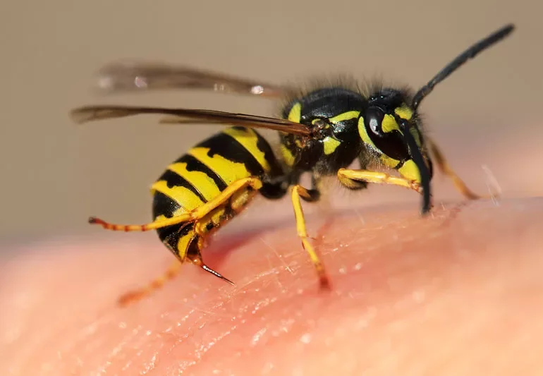 Close-up of a wasp on skin, showing black and yellow striped body, wings, and antennae.