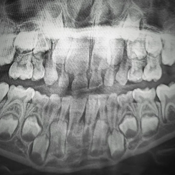 How I became a Megalodon person