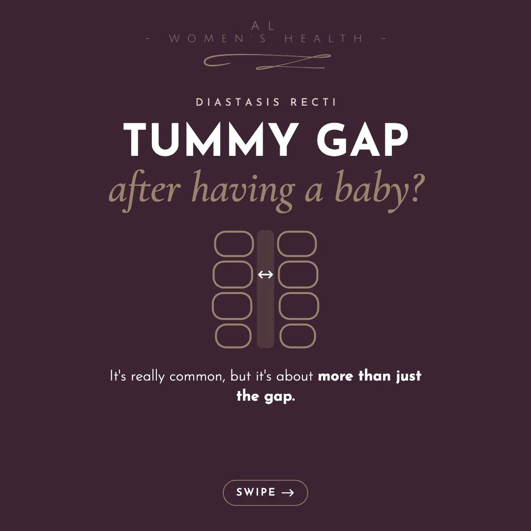 When it comes to recovering from a tummy gap after having a baby, there&rsquo;s more to it than just the gap itself.

Diastasis recti is when the two long tummy muscles down the front get stretched apart during pregnancy, and the tissue between them 