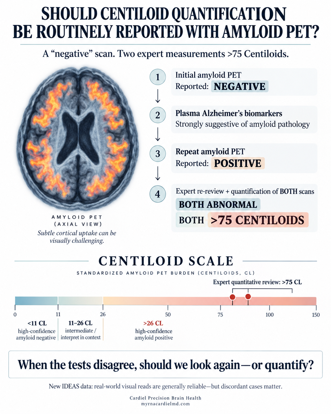 When the Tests Don’t Agree: Why Amyloid PET Sometimes Deserves a Second Look