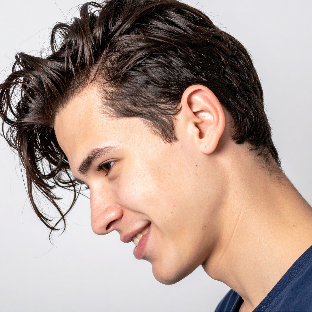 Medspa in Sidney, MT, 59270 l Severe Acne With Isotretinoin Therapy Near Me