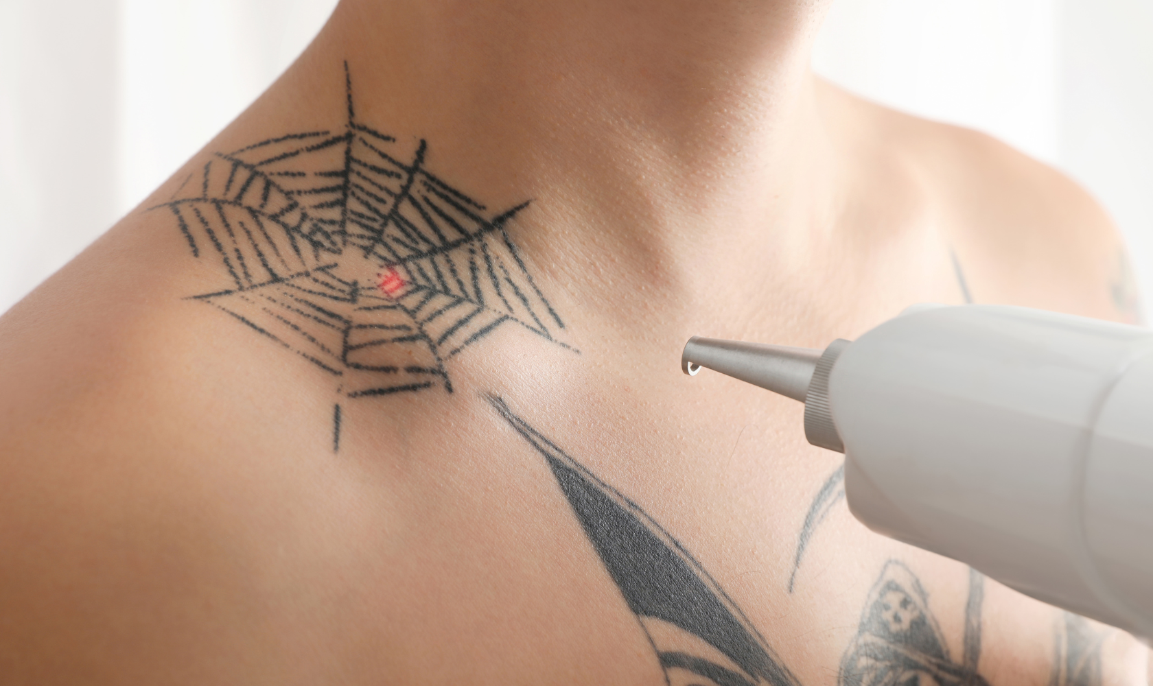 Medspa in Menifee, CA, 92584 Tattoo Removal Near Me.png