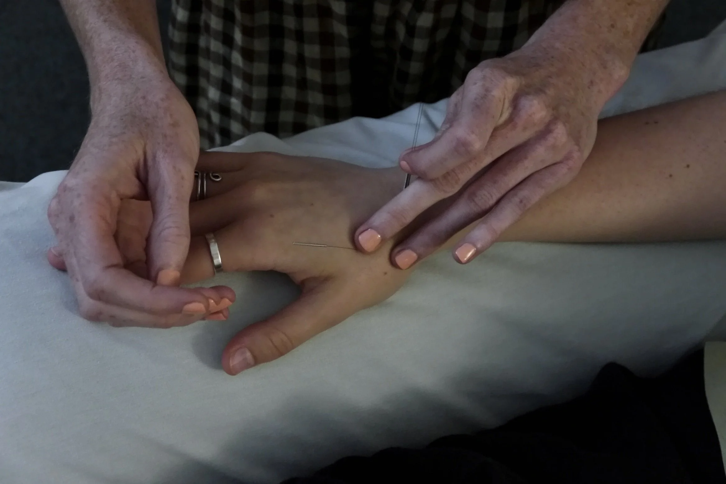 Close-up of a person receiving acupuncture treatment. The practitioner's hands are gently holding and positioning the patient's arm.