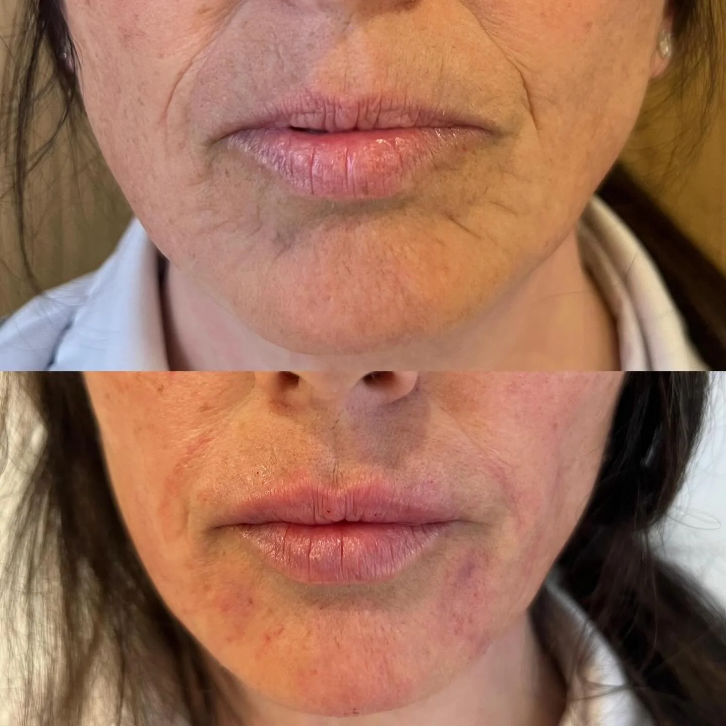 Refresh. Rejuvenated. Natural results 🌿