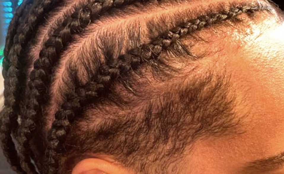 Close-up of a person's scalp showing braided hairstyles and short hair on the sides.