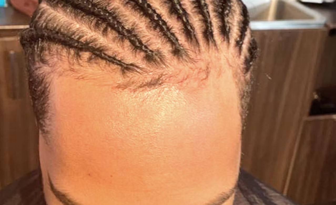 Close-up of a person's forehead with neatly styled cornrow braids, with a background showing wooden cabinets.