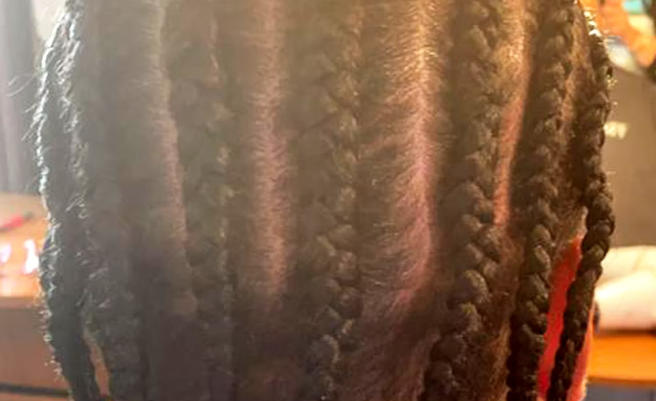 Close-up of a person's head showing tight braids in their hair.
