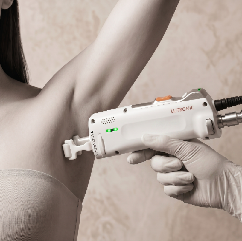 Epilation laser