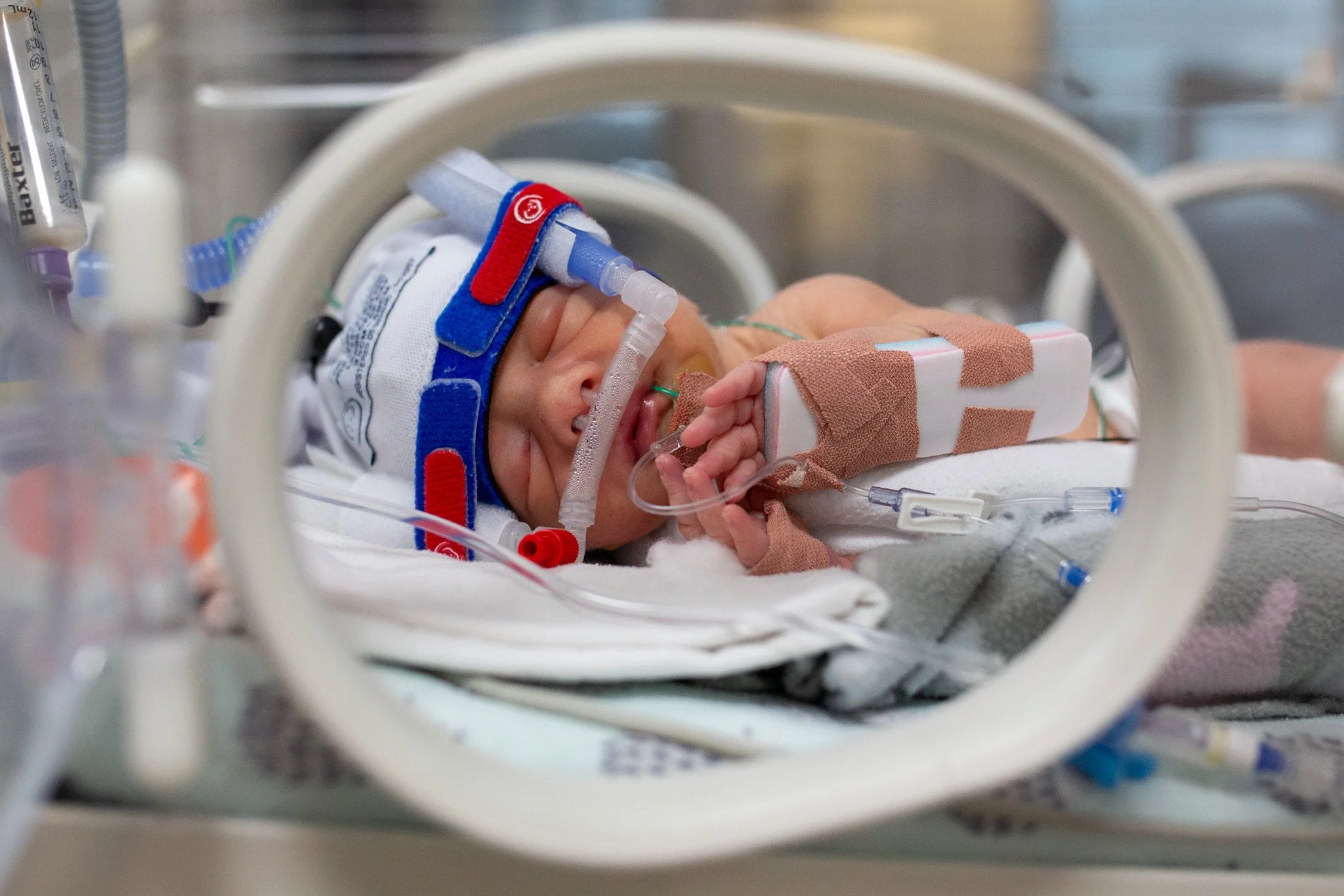 nicu-premature-newborn-photography-christchurch-nz-7.jpg