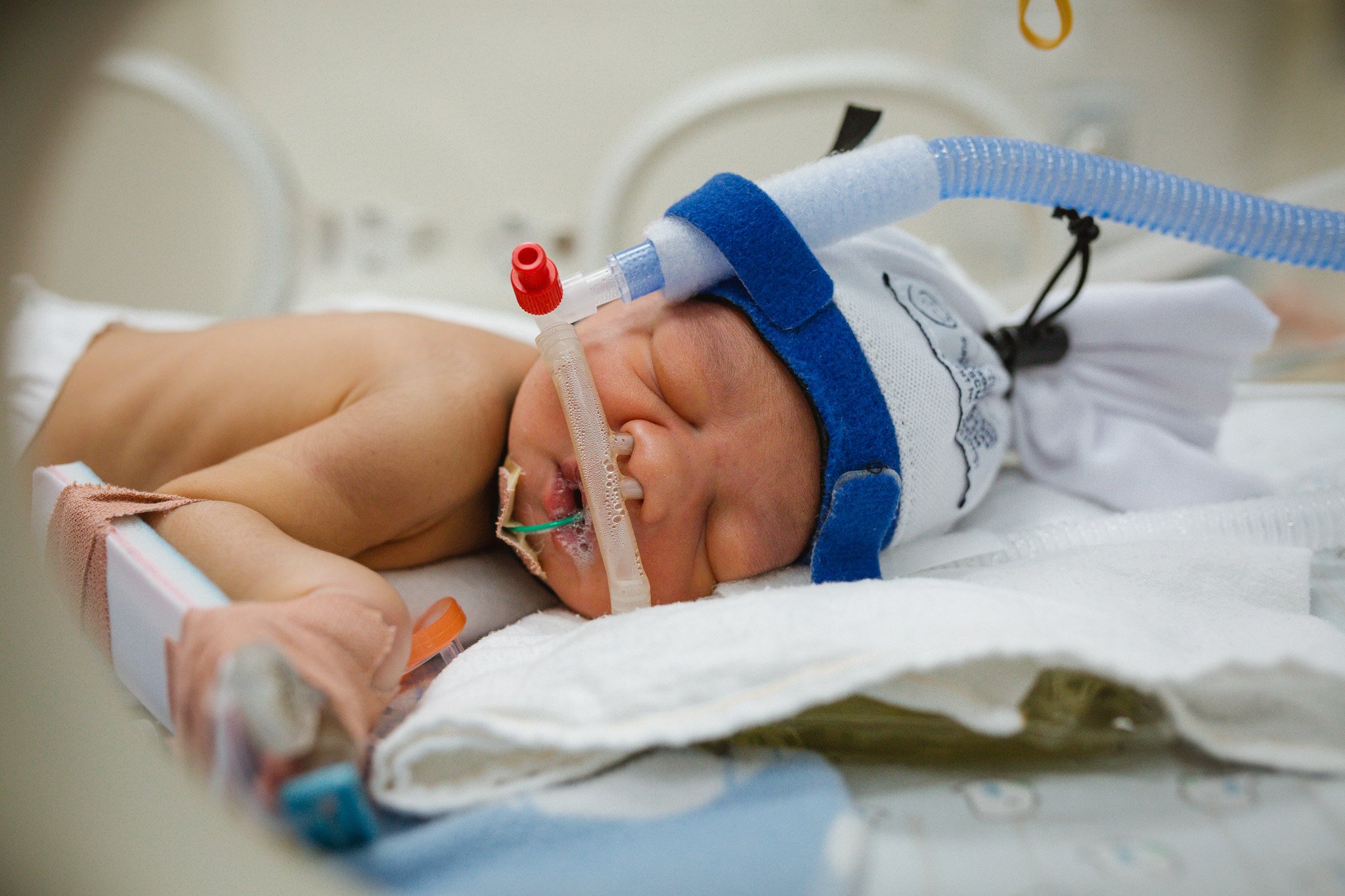 nicu-premature-newborn-photography-christchurch-nz-17.jpg