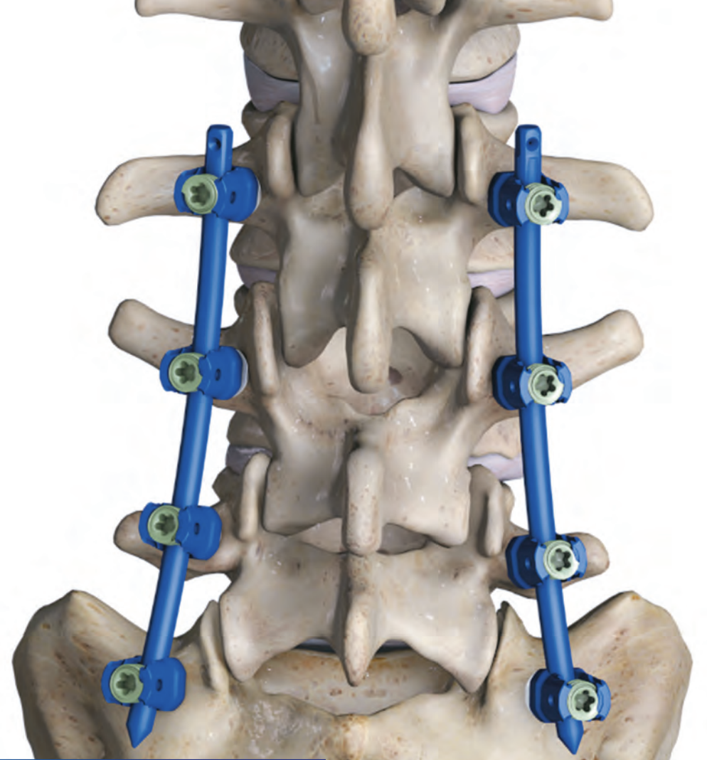 Medical Device