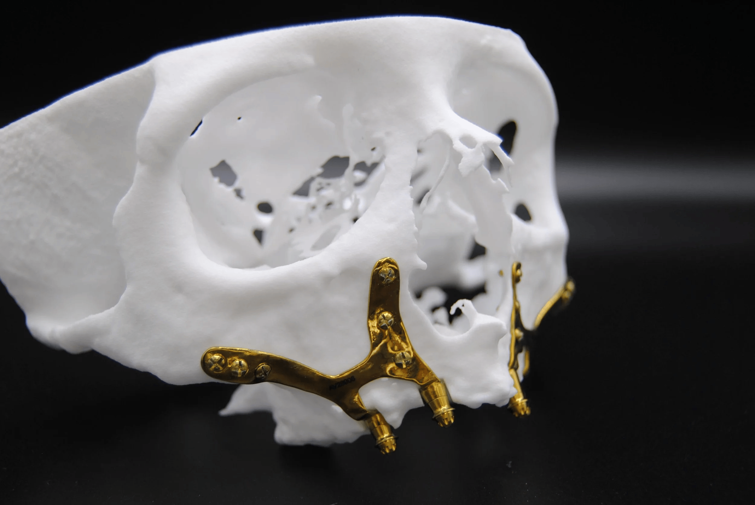 A detailed view of a skull with small gold decorative ornaments attached to it, set against a black background.
