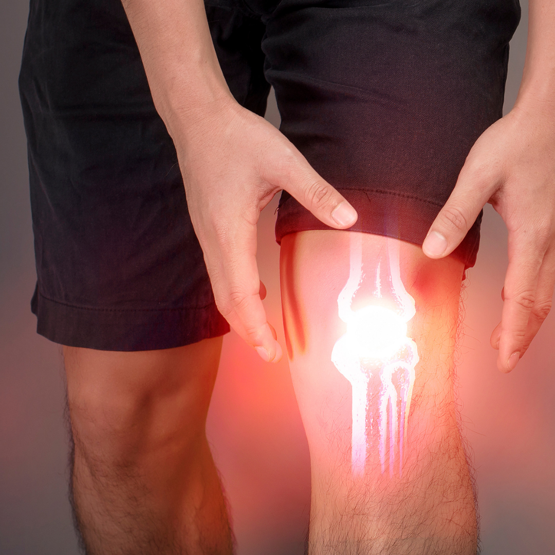 A Case Study: The Troublesome Knee