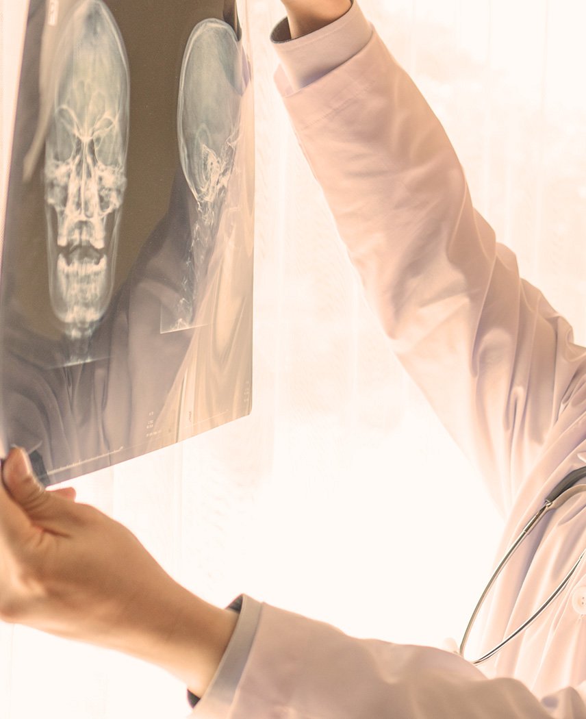 concussive headache and posttraumatic headache