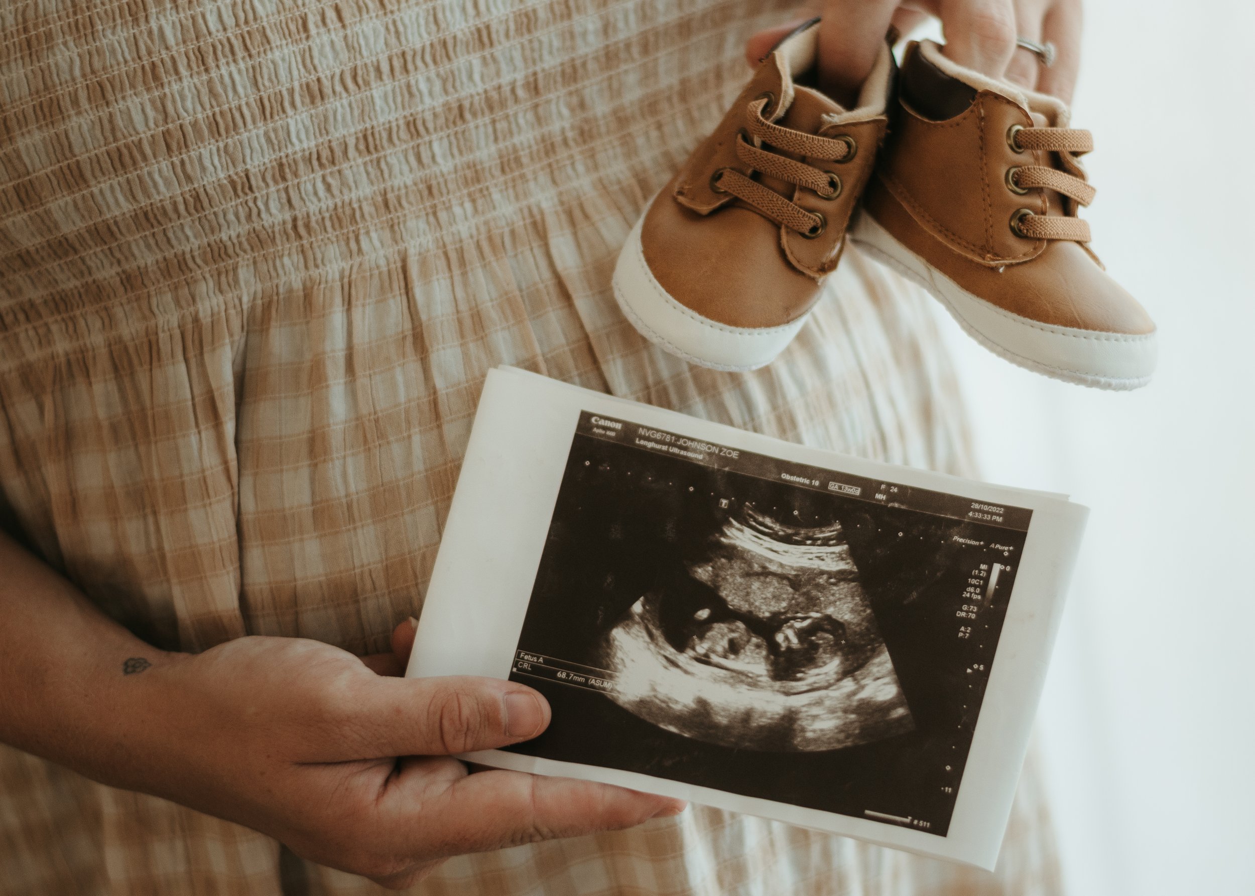 Person holding an ultrasound image of a fetus in black and white.