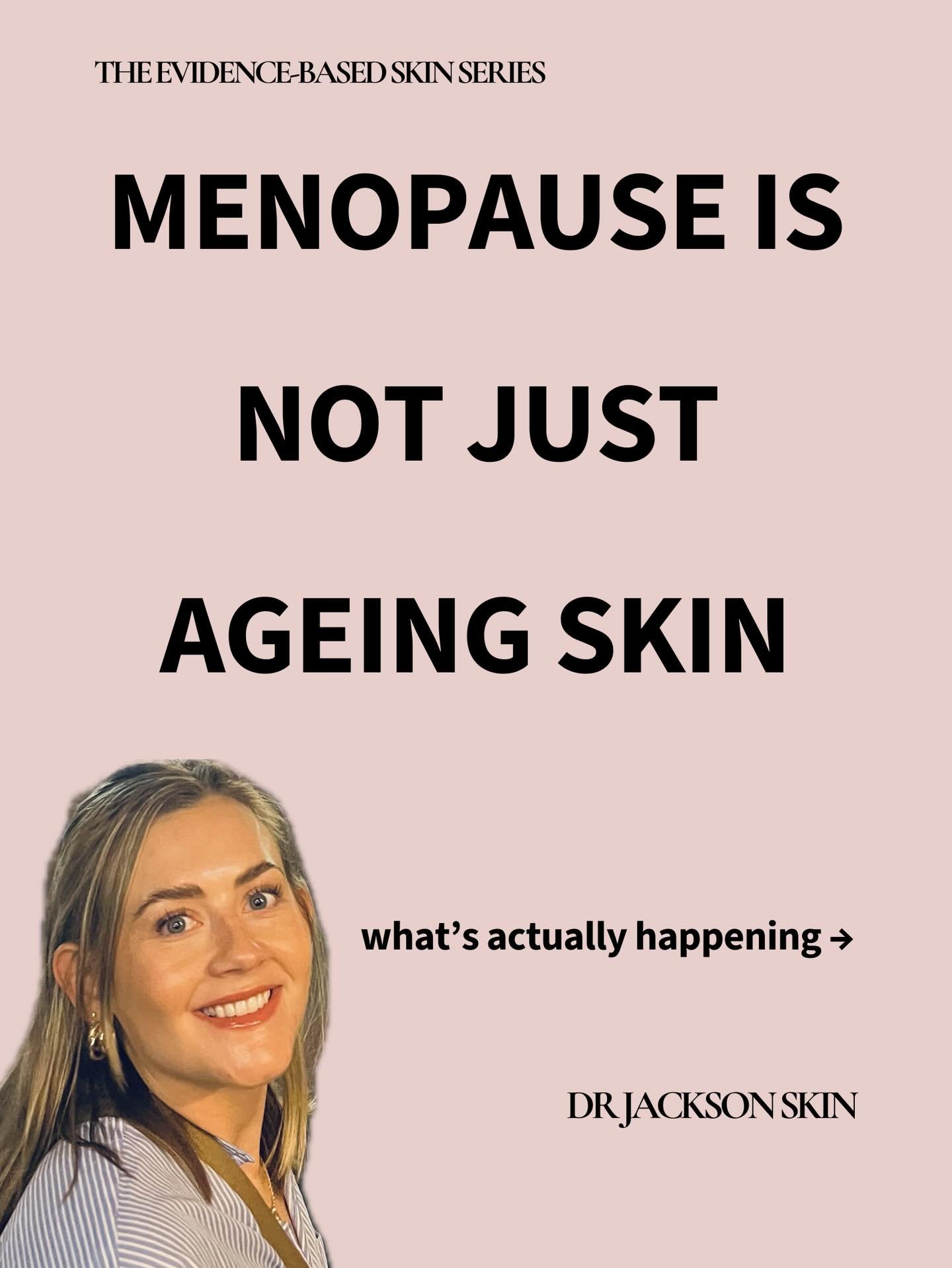 If your skin suddenly feels dry, sensitive, breaking out&hellip;&amp; just out of control - you&rsquo;re not imagining it.

Menopause skin changes aren&rsquo;t random. They&rsquo;re driven by a huge hormonal shift 💥

What I see all the time in clini