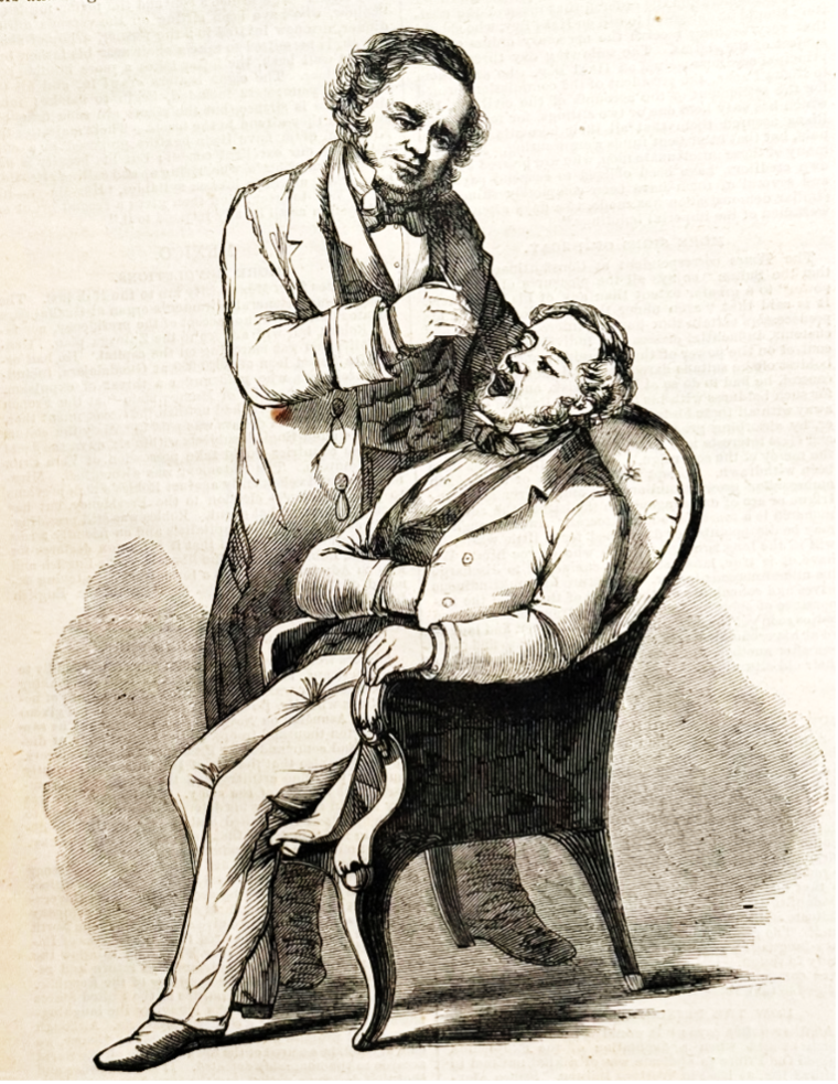 Horace Green intubating with a whale bone