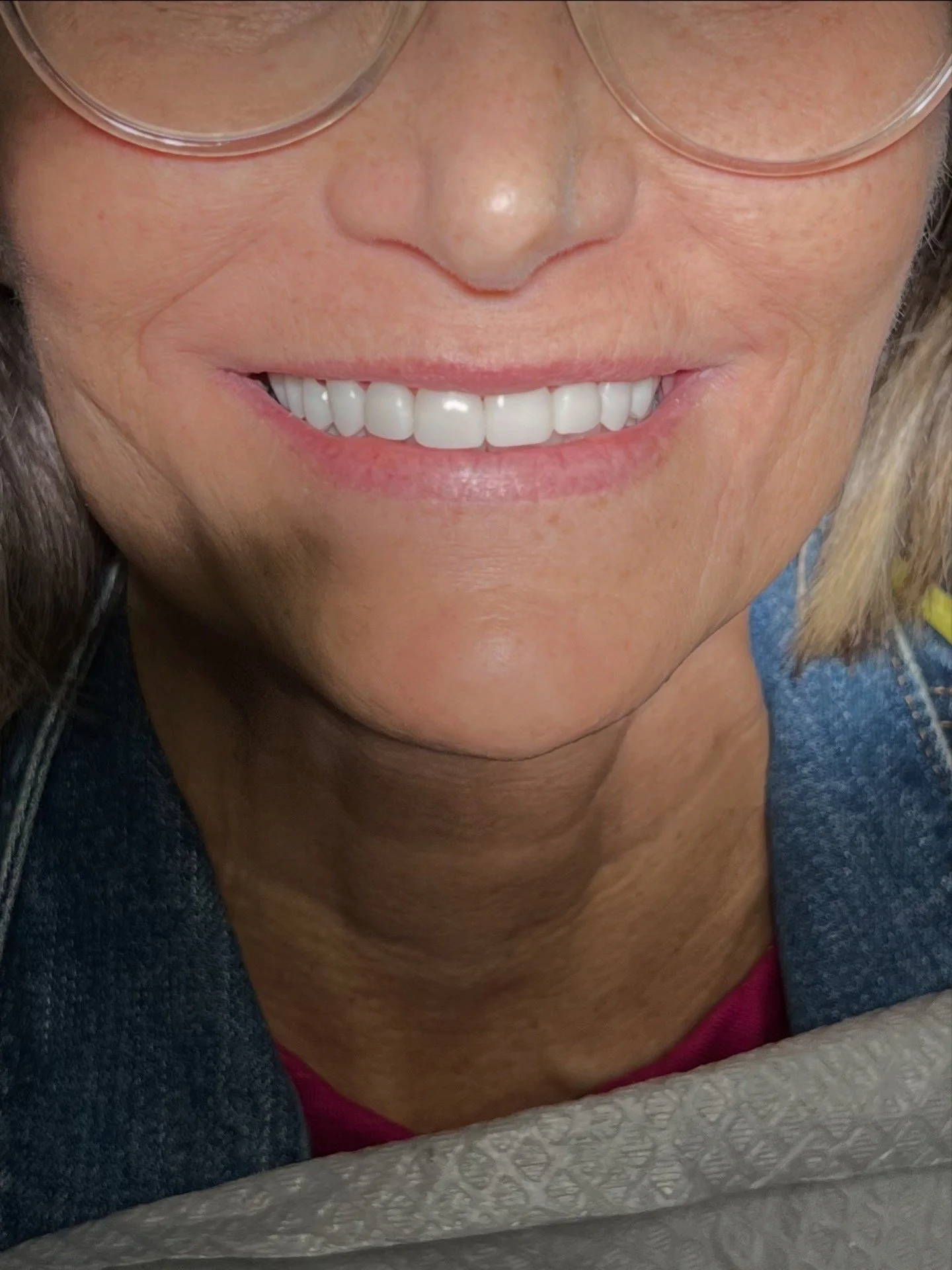 Close-up of a woman's face showing her smile with white teeth, wearing glasses and a dark blue jacket.