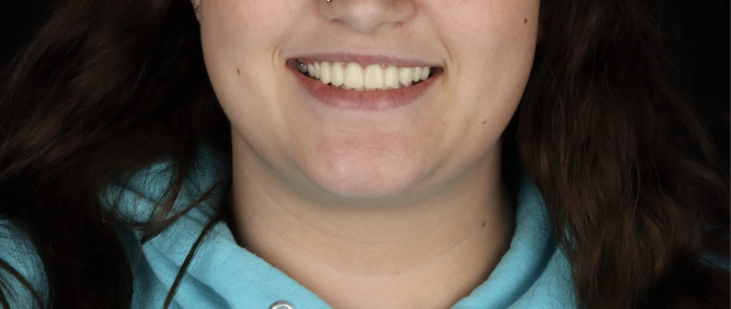 Close-up of a woman smiling showing her teeth, she has long brown hair and is wearing a blue hoodie.