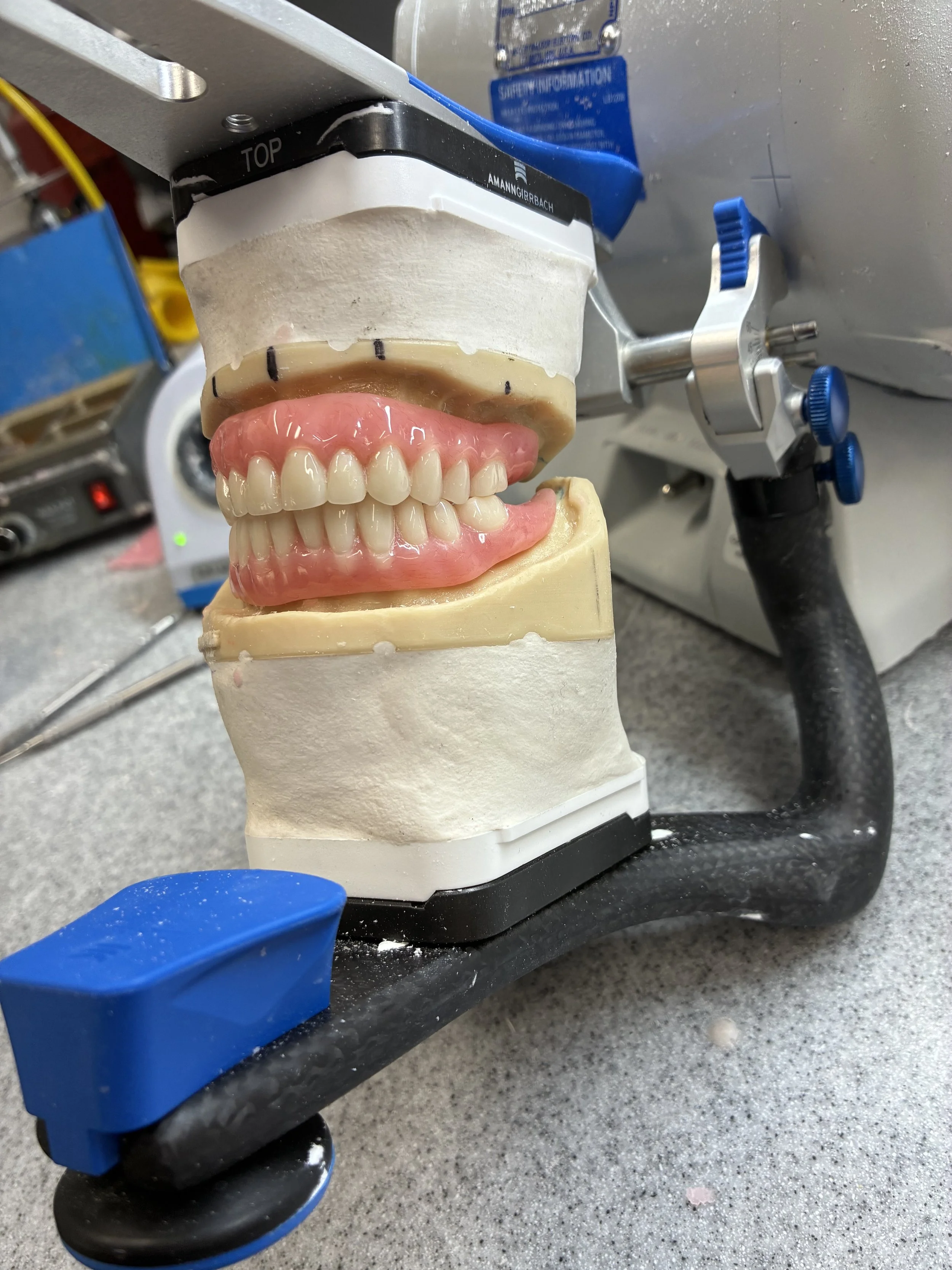 Dental prosthetic teeth mounted on a dental model, positioned on a metal workbench with various dental tools and equipment in the background.