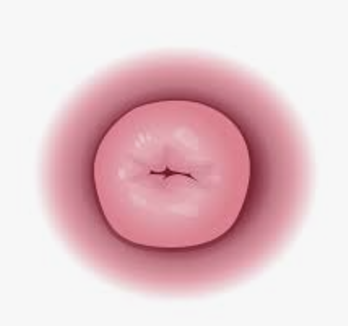 What is Cervical Health and Why is it Important?