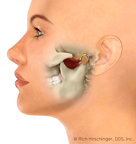 An illustration of the human head showing a cross-section of the nasal cavity and sinuses.