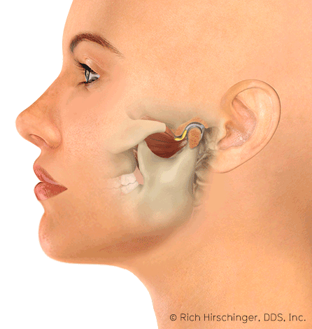 An illustration showing the anatomy of the human ear with a focus on the inner ear, including the ear canal, eardrum, cochlea, and other structures.