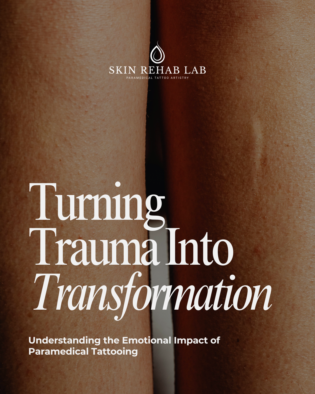 Turning Trauma Into Transformation E-Books