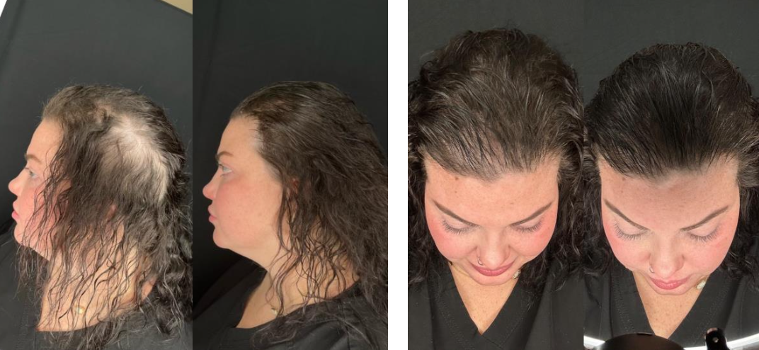 Comparison of before and after hair treatments showing improved hair health and style from side and top views.