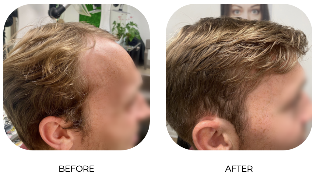 Side-by-side comparison of a man's hair before and after a haircut. In the 'before' image, his hair is longer and slightly unkempt. In the 'after' image, his hair is shorter, styled, and neater.