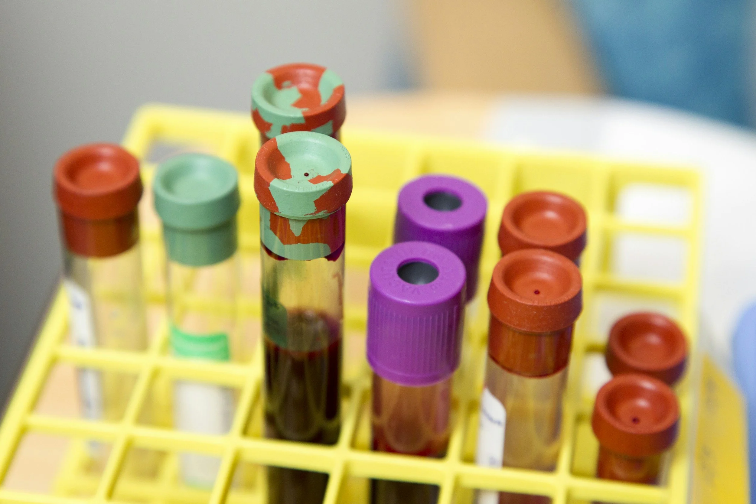 Vacutainers, Vacuum Blood Collection Tubes