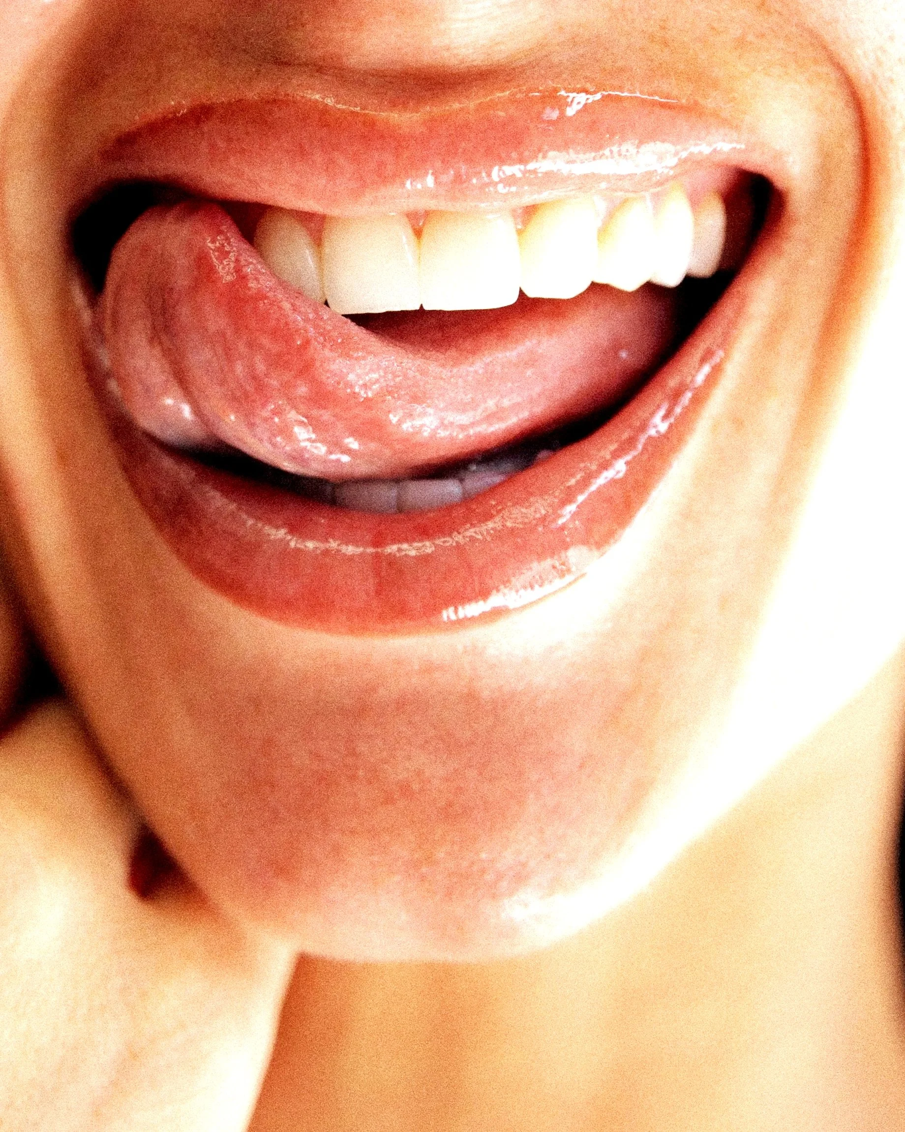 Professional teeth whitening treatment in Austin, TX.