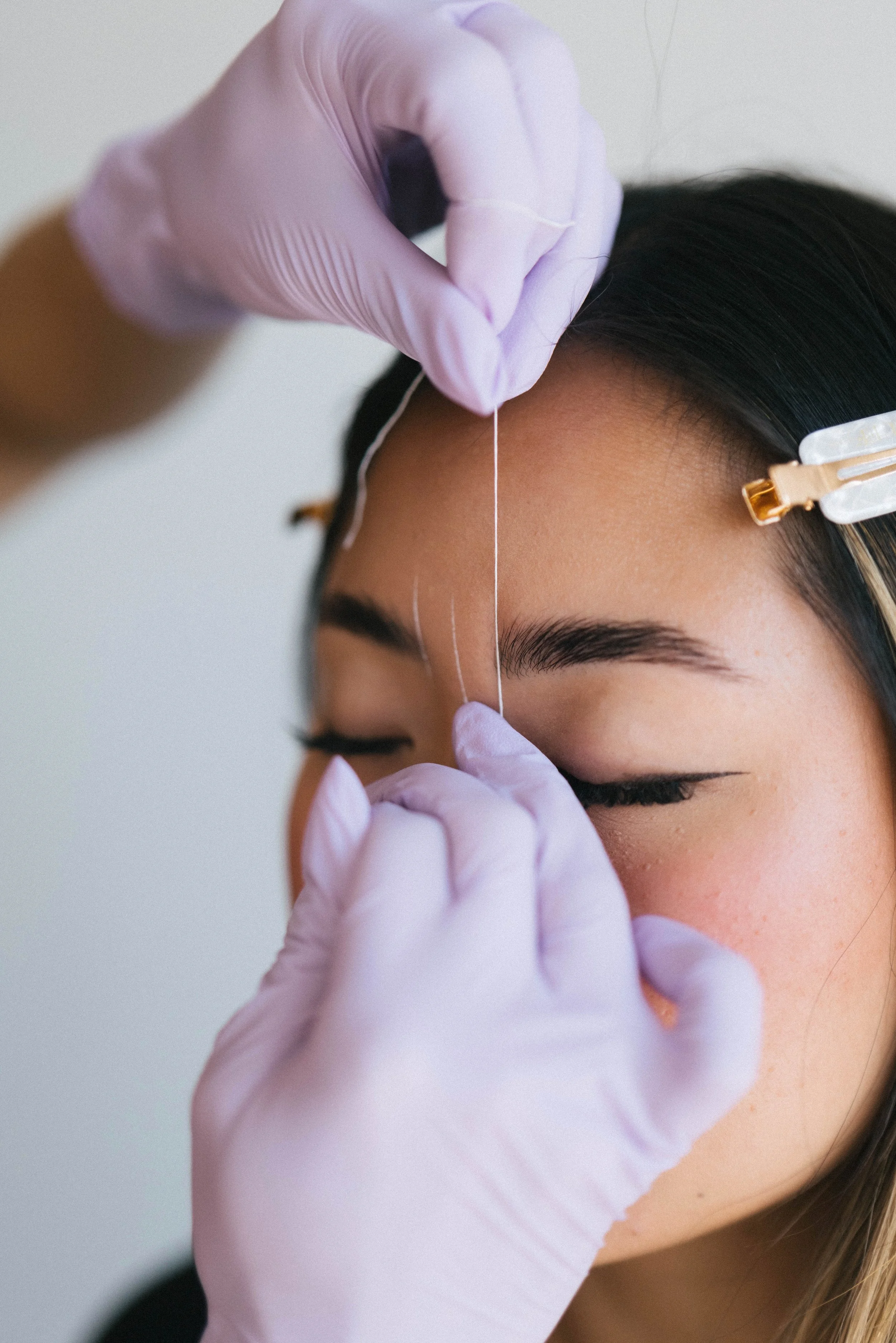 A person wearing purple gloves is inserting a needle into another person's forehead, likely for a cosmetic or medical procedure.