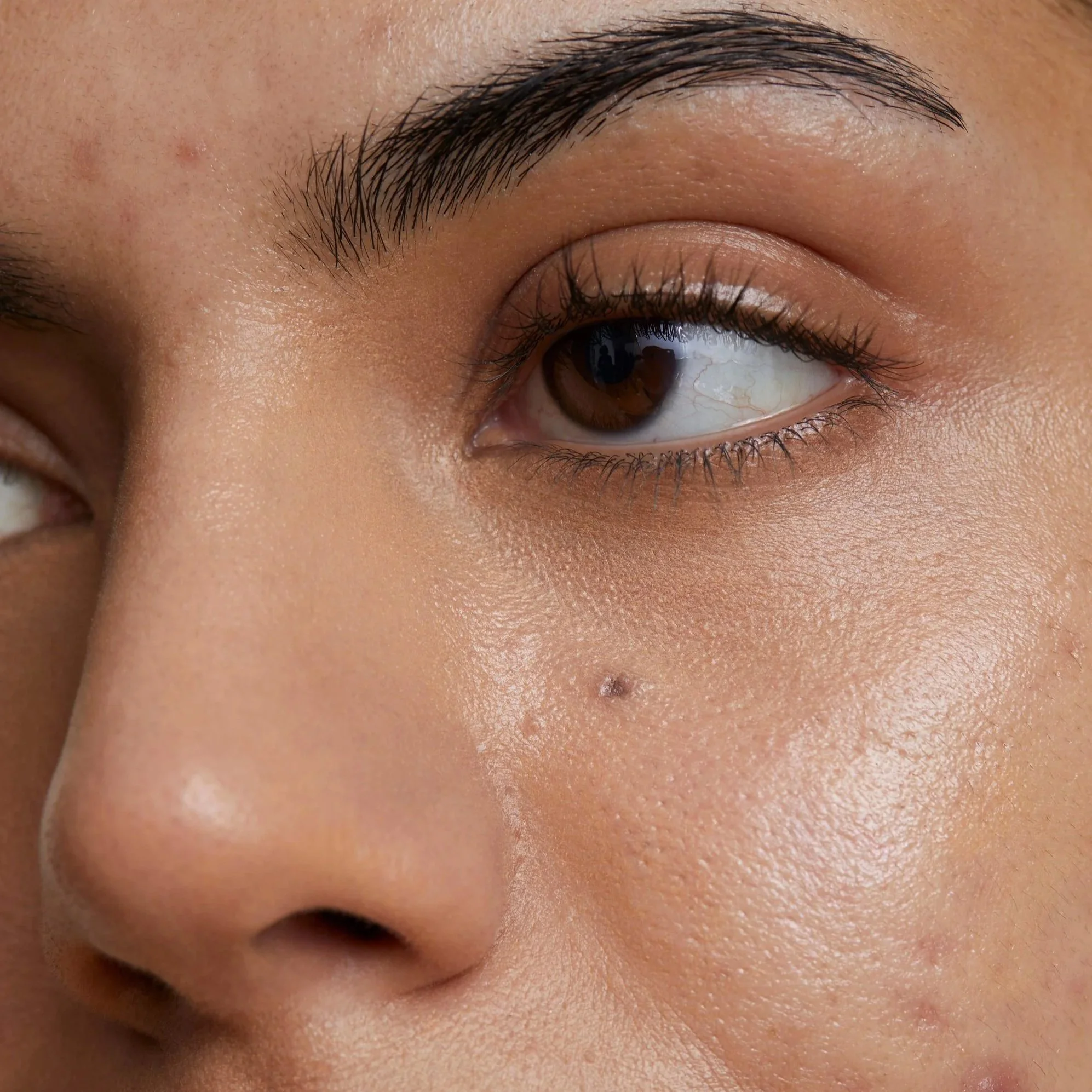 Close-up of a person's eye and eyebrow with dull, scarred skin and natural makeup.